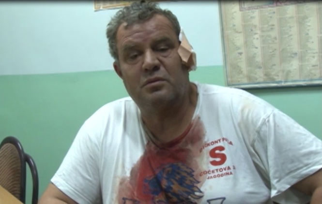 Napadnut domar ispred škole u Vitini