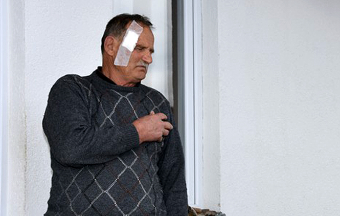 Pretučen Srbin u blizini Istoka, napadač uhapšen