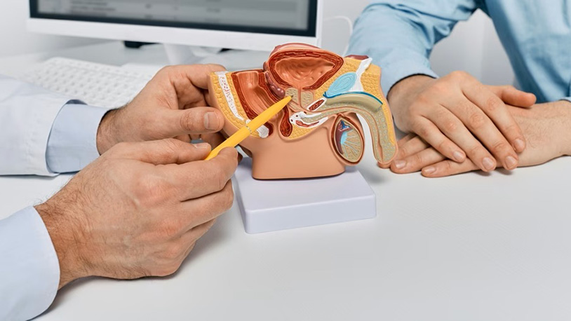 U Srbiji godišnje oko 1.000 muškaraca umre od raka prostate rak prostate