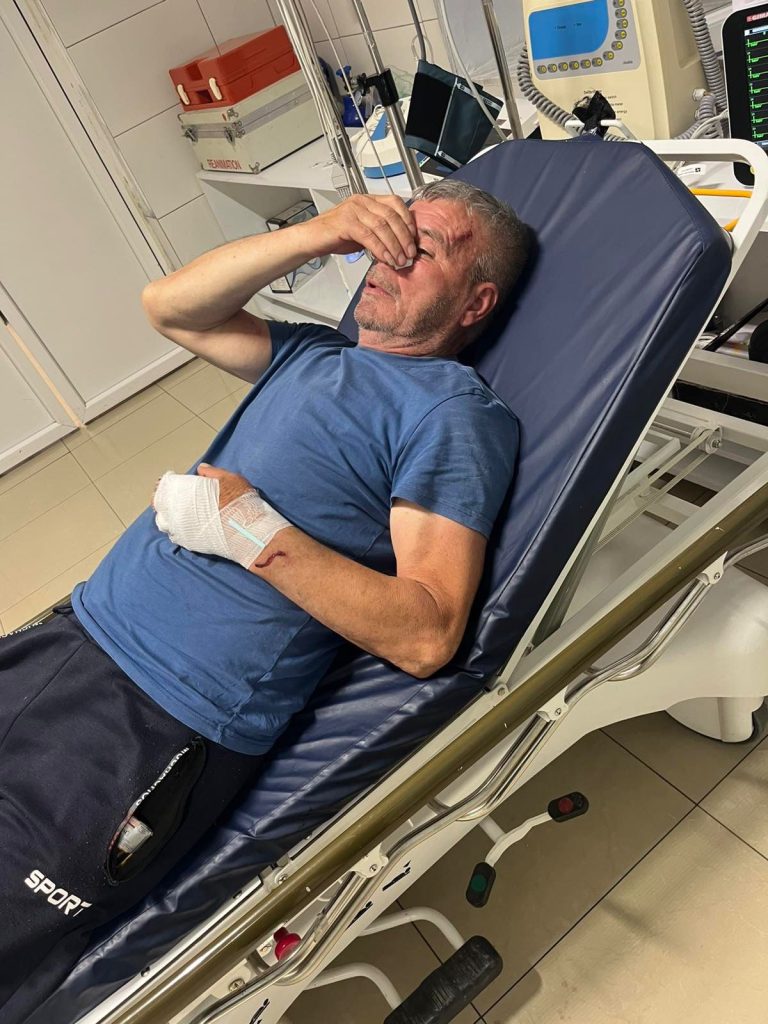 Kancelarija za KiM: Srbin na Kosovu pretučen dok je pokušao da odbrani sina od napadača Pretuceni Sveta Ilić iz sela Binač (Foto: Kancelarija za KiM)